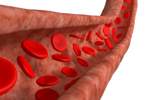peripheral artery disease (pad)